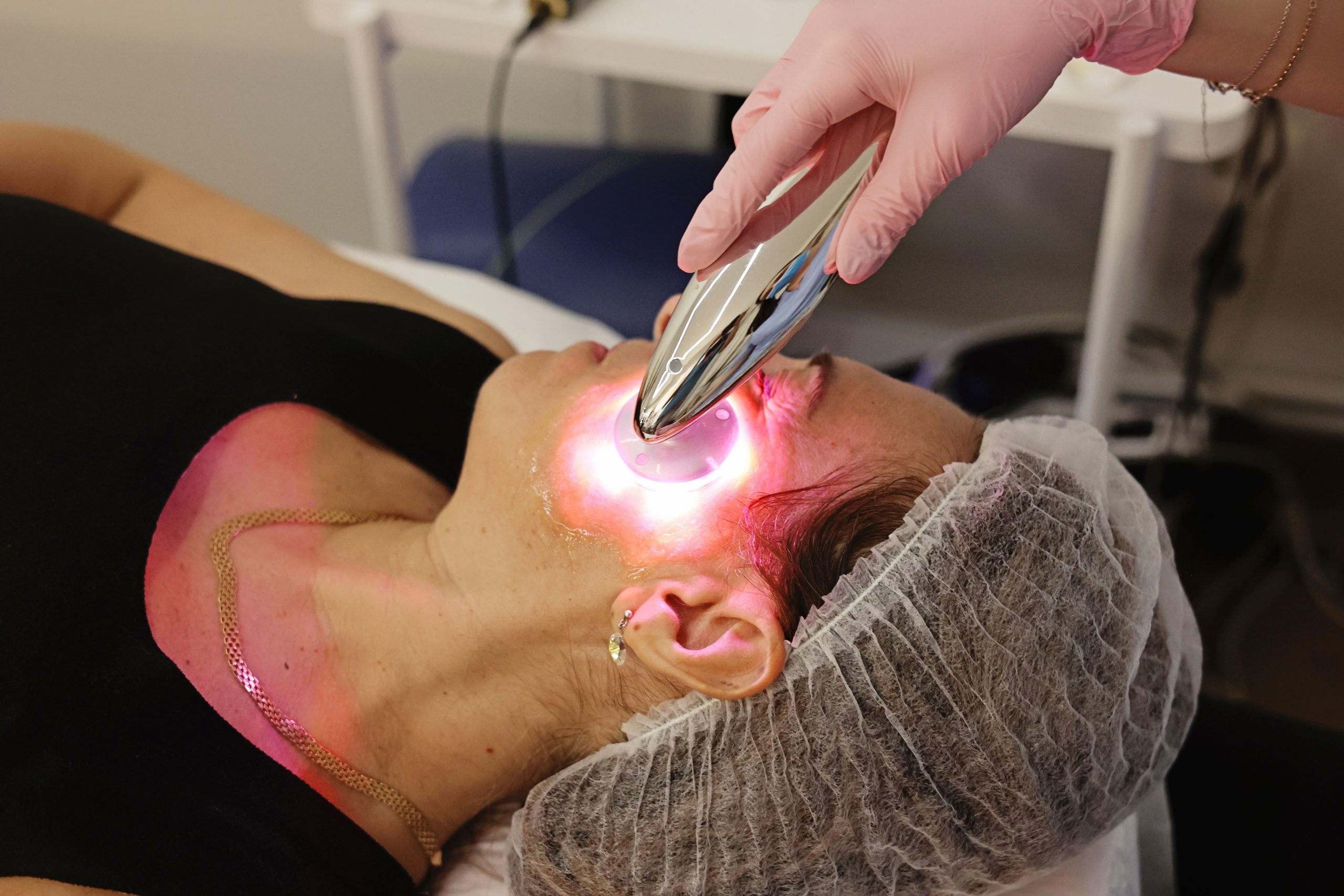 biomicroneedling