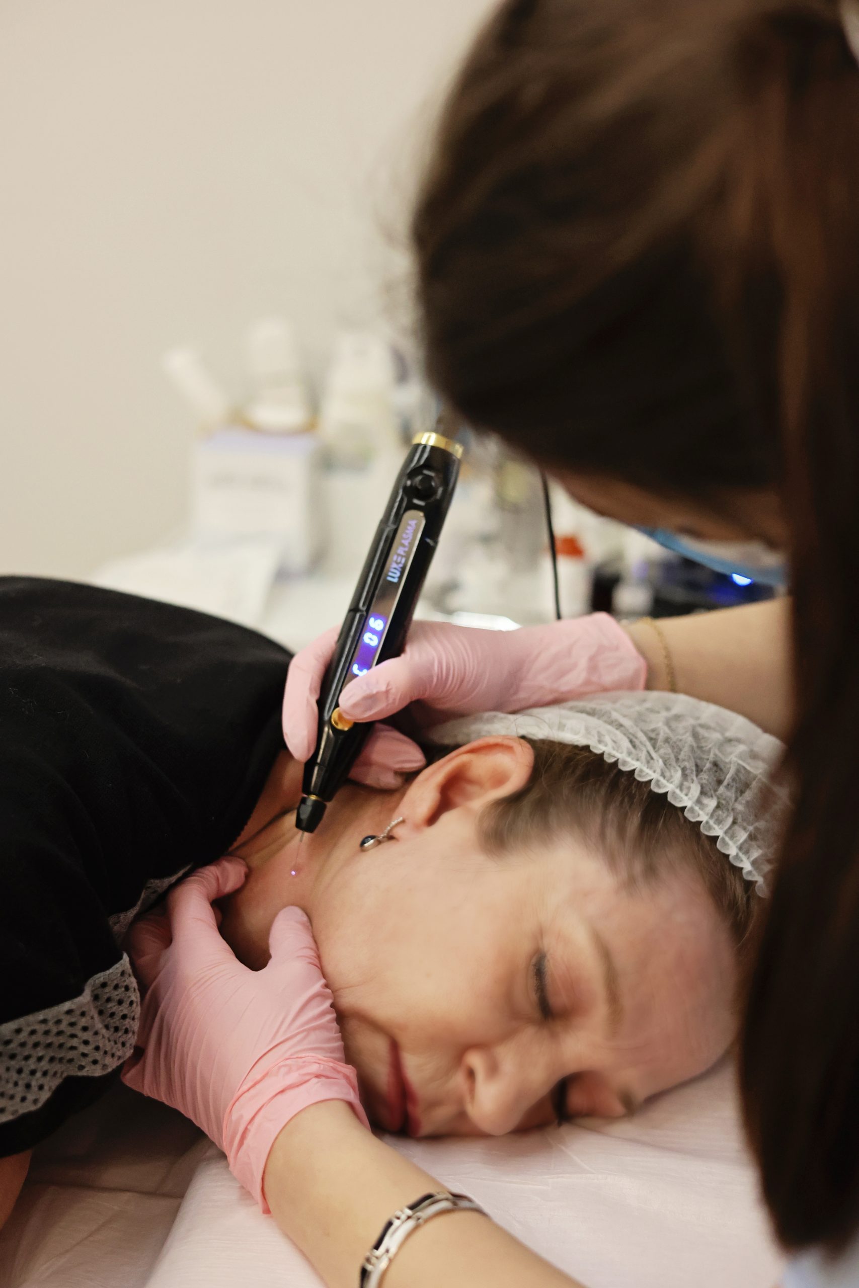 loyalskin208 plasma pen