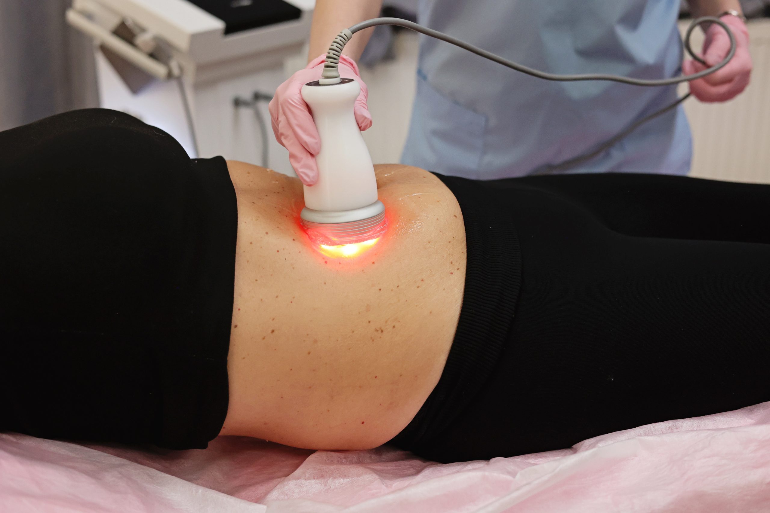 loyalskin60 himfu Remodelarea corporală