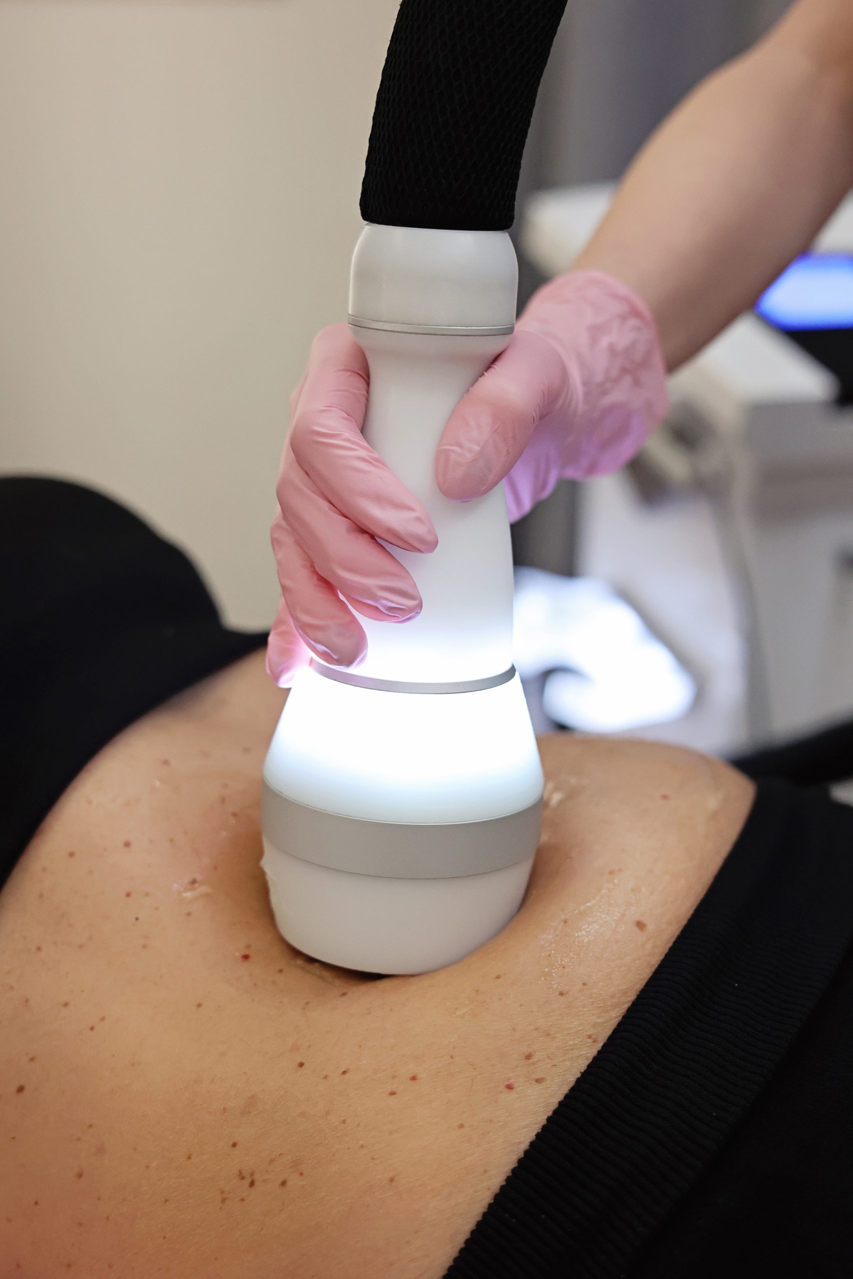 remodelare corporala