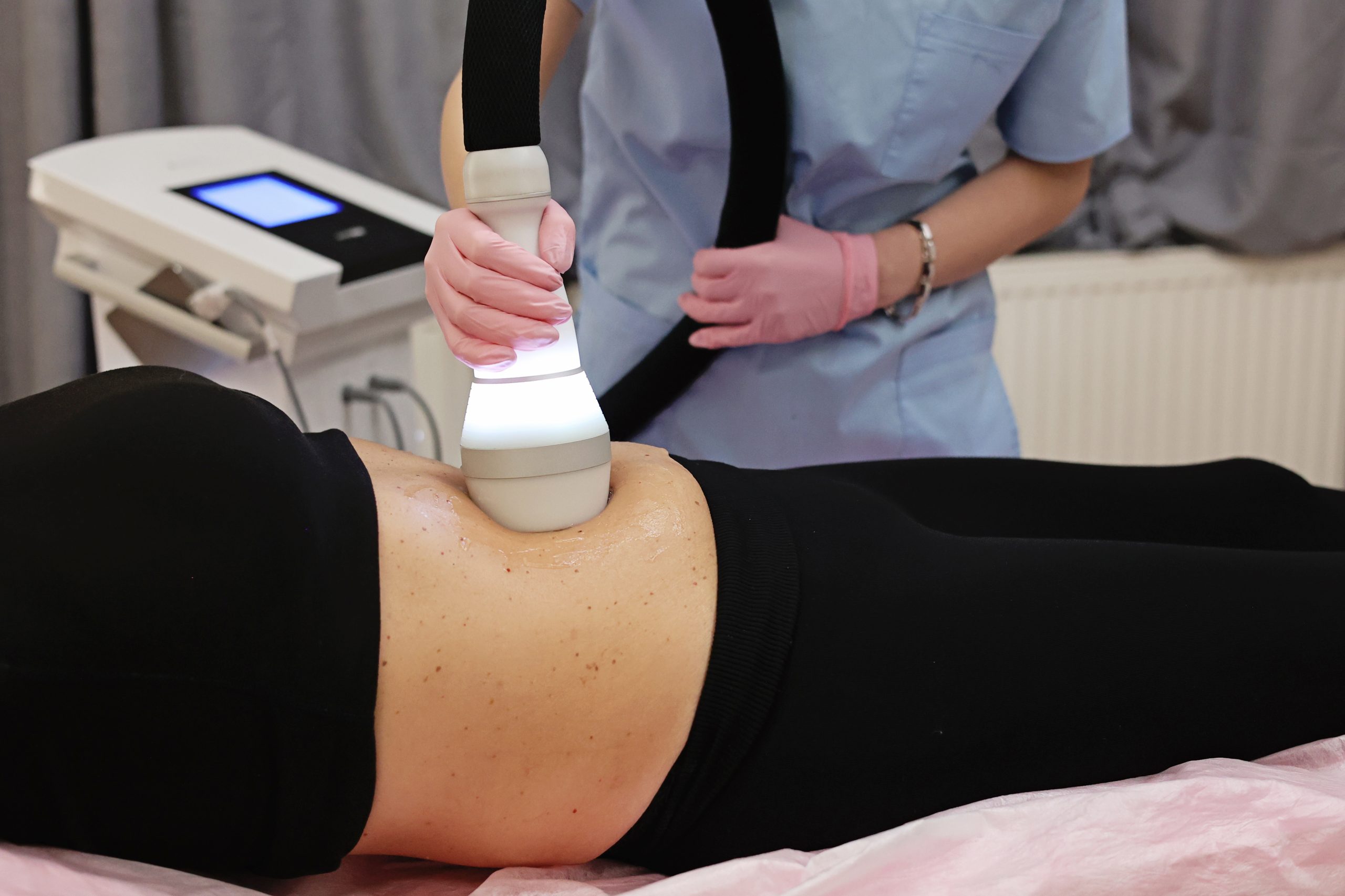 loyalskin71 crioterapie Remodelarea corporală