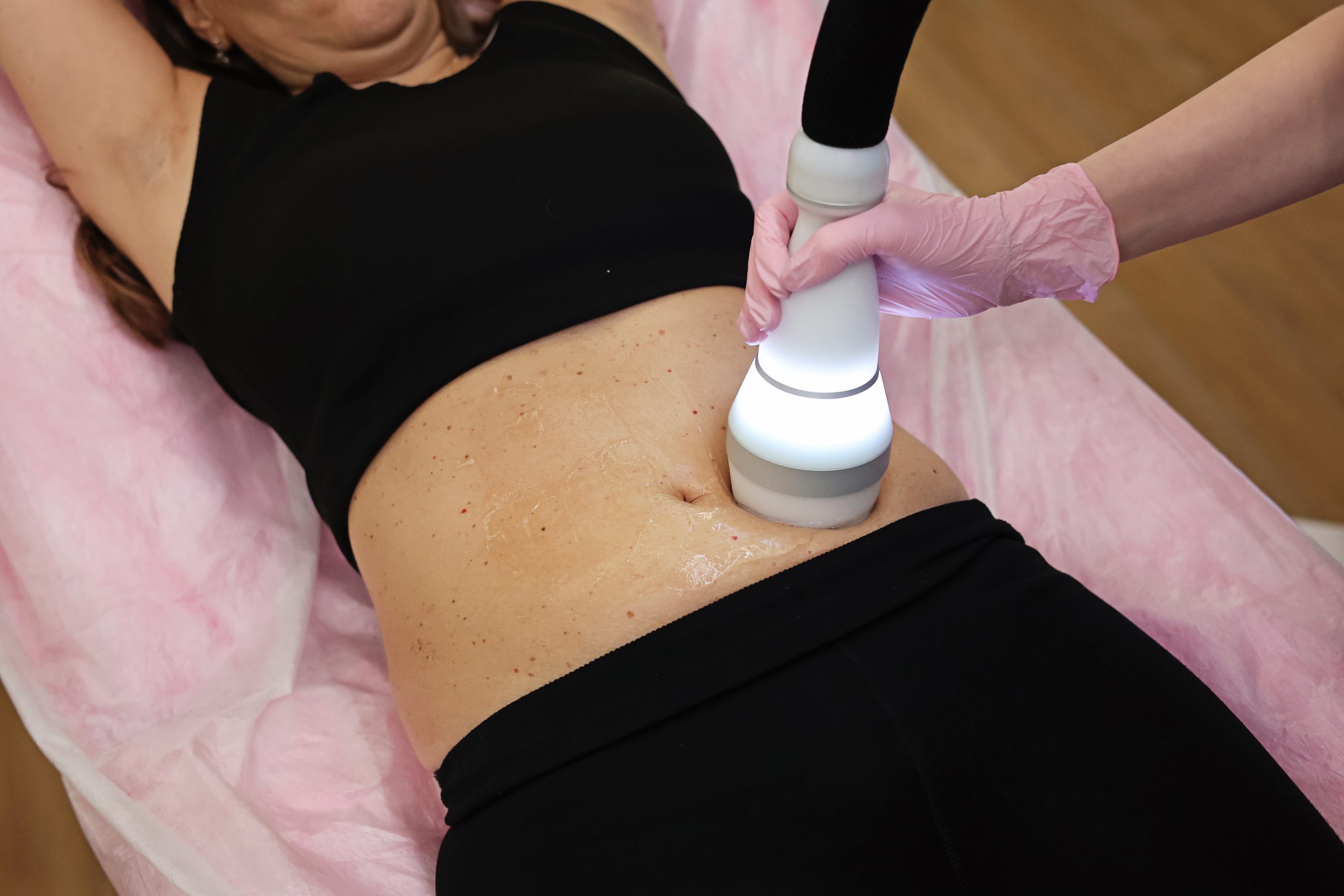 remodelare corporala