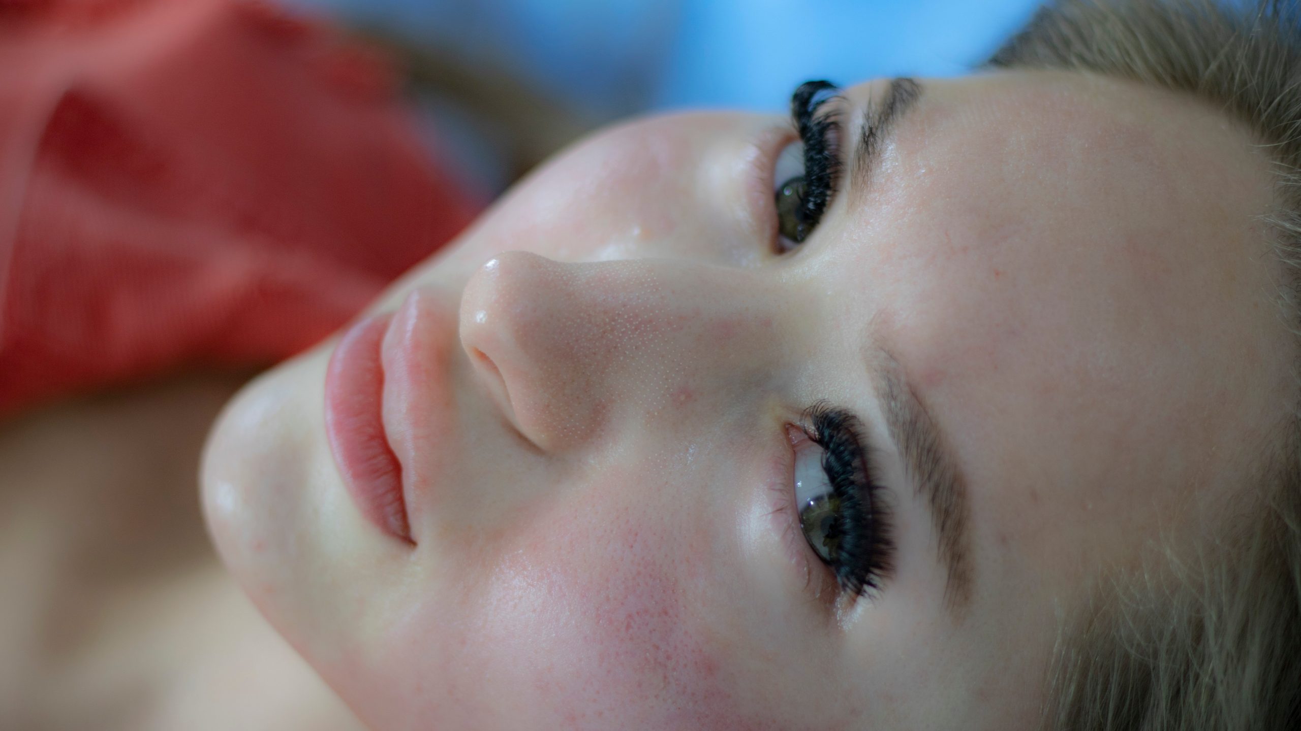 roșeața, acnee rozacee, ten sensibil, ten irita, tratament facial