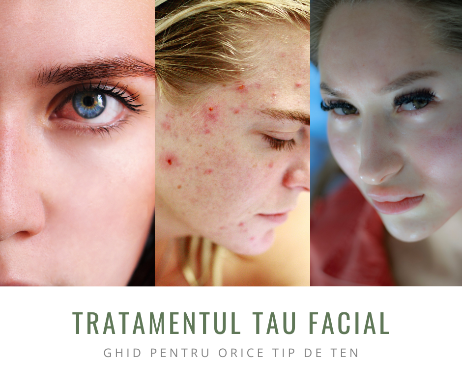 Tratament facial, ten cu acnee, ten sensibil, roșeața fetei