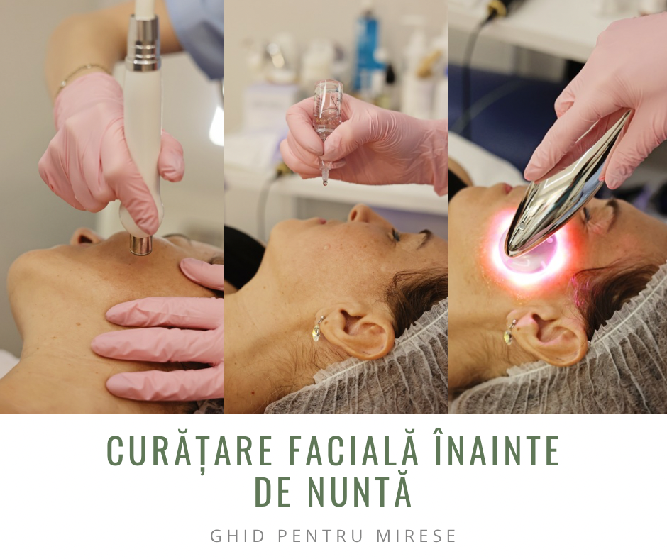 Curățare facială înainte de nuntă, ghid pentru mirese