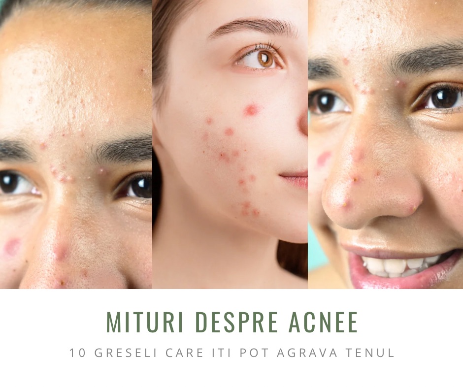 acnee, mituri, coșuri, curățare faciala